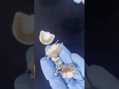 Çok iyi çıkartmalar ile özelleştirilebilir Kobalt Chrome dökme çerçeve