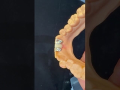 Diş Dişleri PFM Maryland Köprüsü Yüksek Estetik FDA Sertifikalı