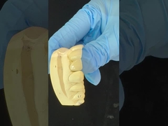 Tam Kontürlü Zirkonya Tacı/Yüksek Estetik Doğal Özel Aydit Zirkonya Diş Köprüsü