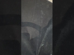 Titanyum İmplant Desteklenmiş Diş Dişleri Implantlar Üzerine Kesin Ivoclar Diş Dişleri