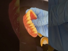 Tam üst ve alt durak plaka Akrilik kısmi diş protezleri Ivoclar Dişler Pembe Sakız