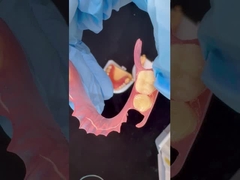 3D Baskı Modeli Yüksek Estetik Diş TCS Valplast Esnek Kısmi Diş Dişleri Diş Laboratuvarı